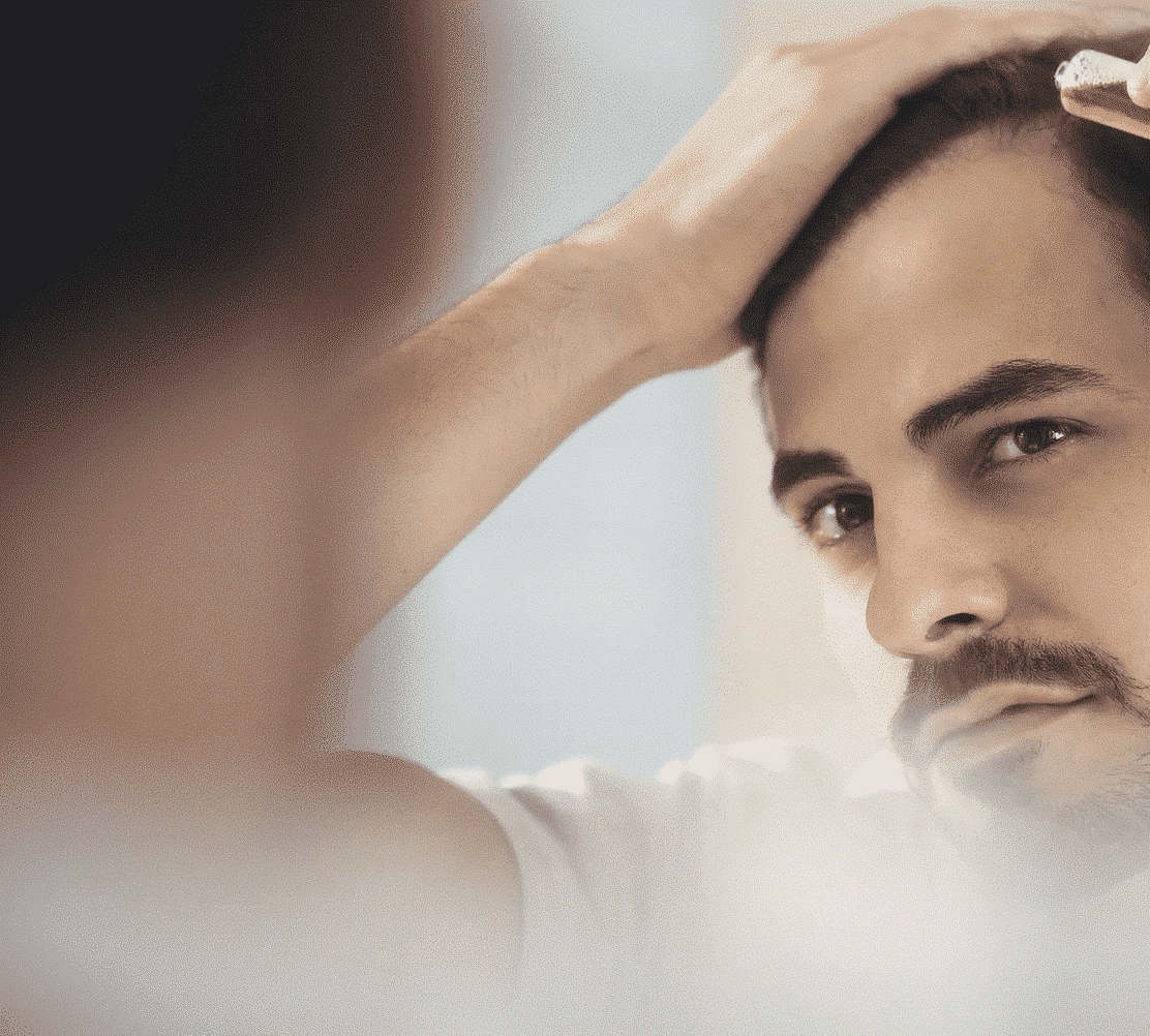 Patient after successful hair transplant