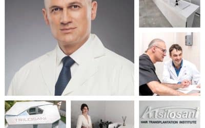Artas Cheveux : La Révolution pour une Transplantation Capillaire Naturelle